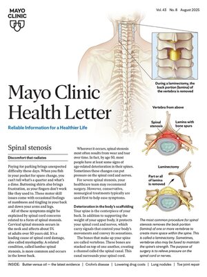 cover image of August 2025. Mayo Clinic Health Letter